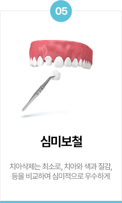 심미보철
