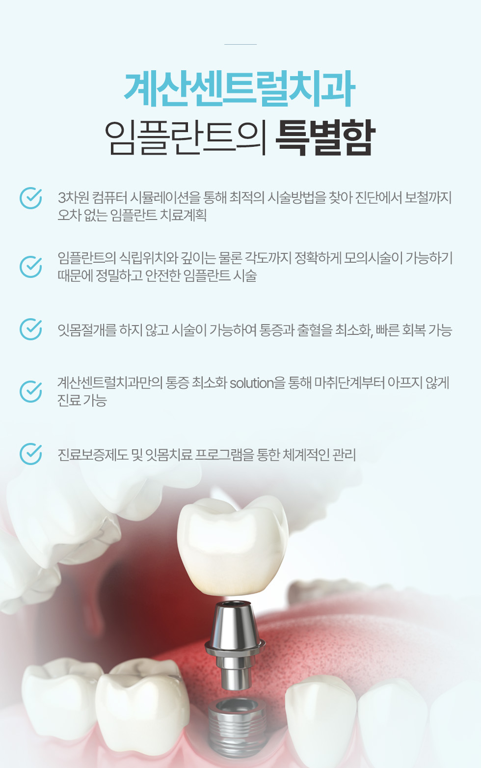 계산센트럴치과 임플란트의 특별함