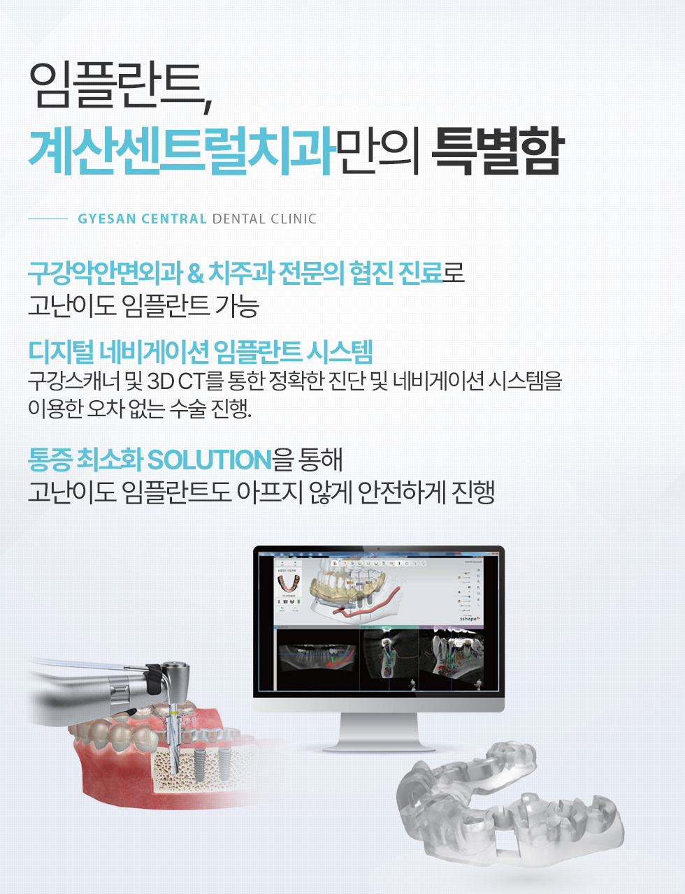 임플란트, 계산센트럴치과만의 특별함