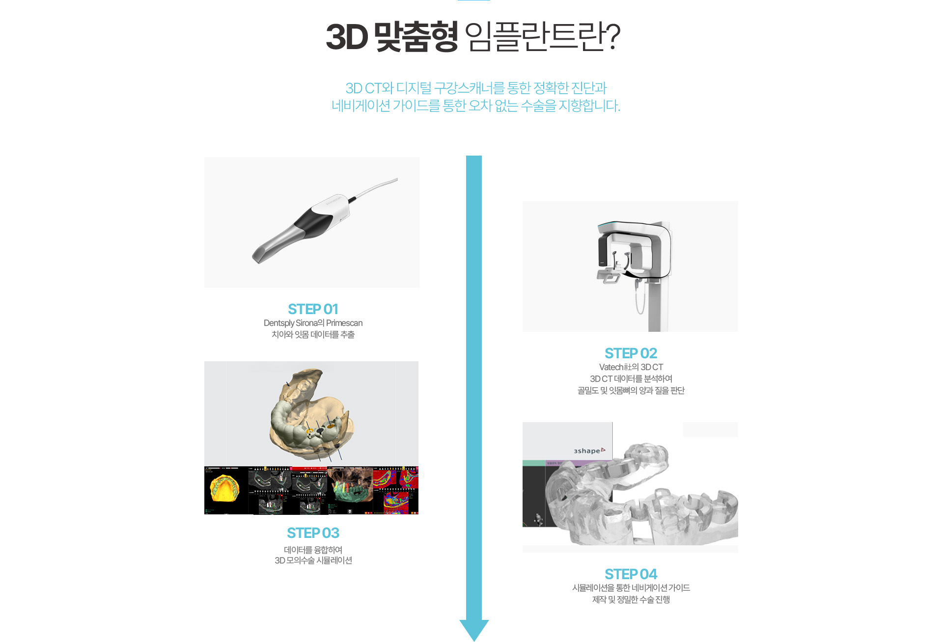 3D 맞춤형 임플란트란?