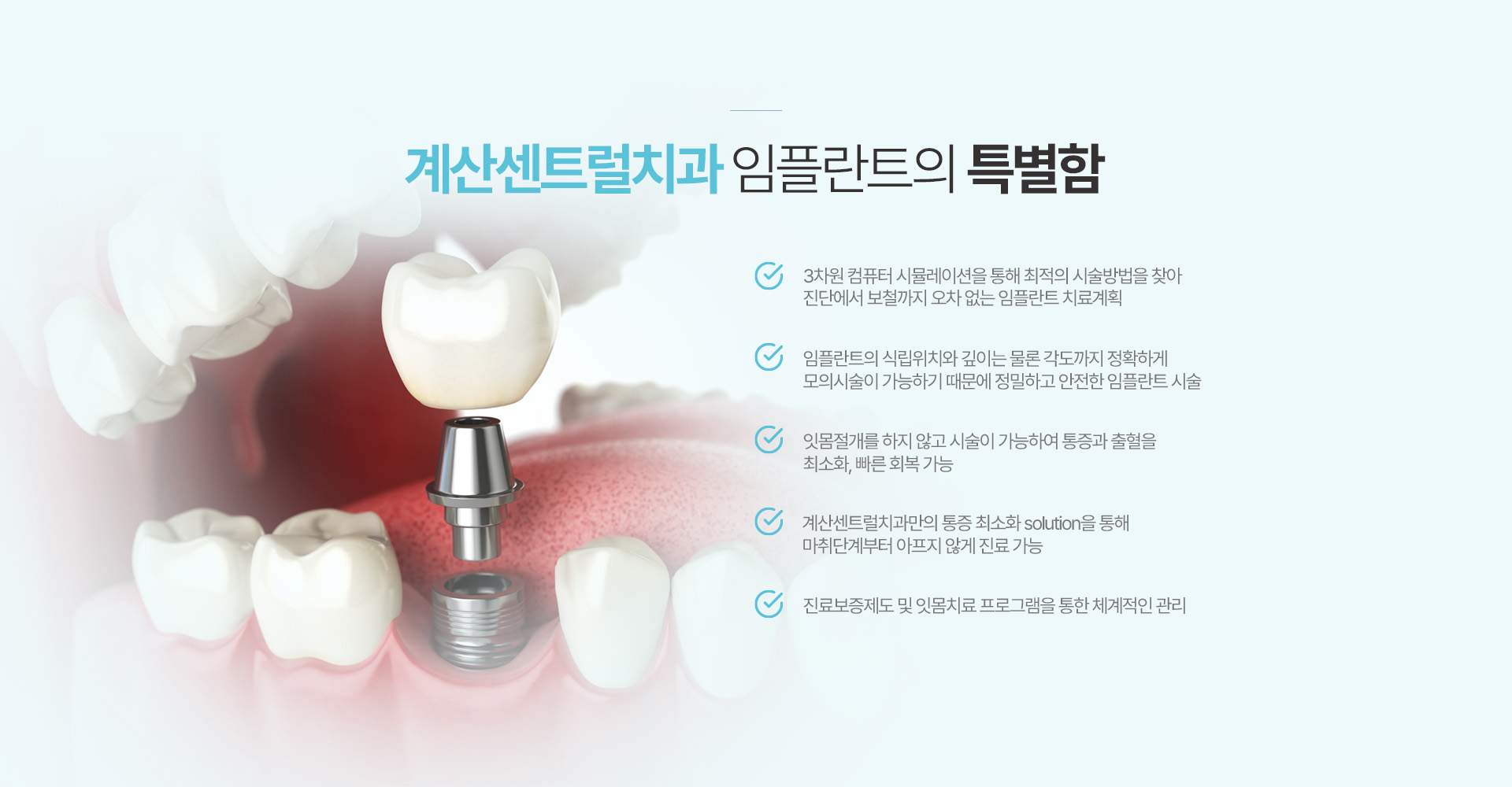 계산센트럴치과 임플란트의 특별함