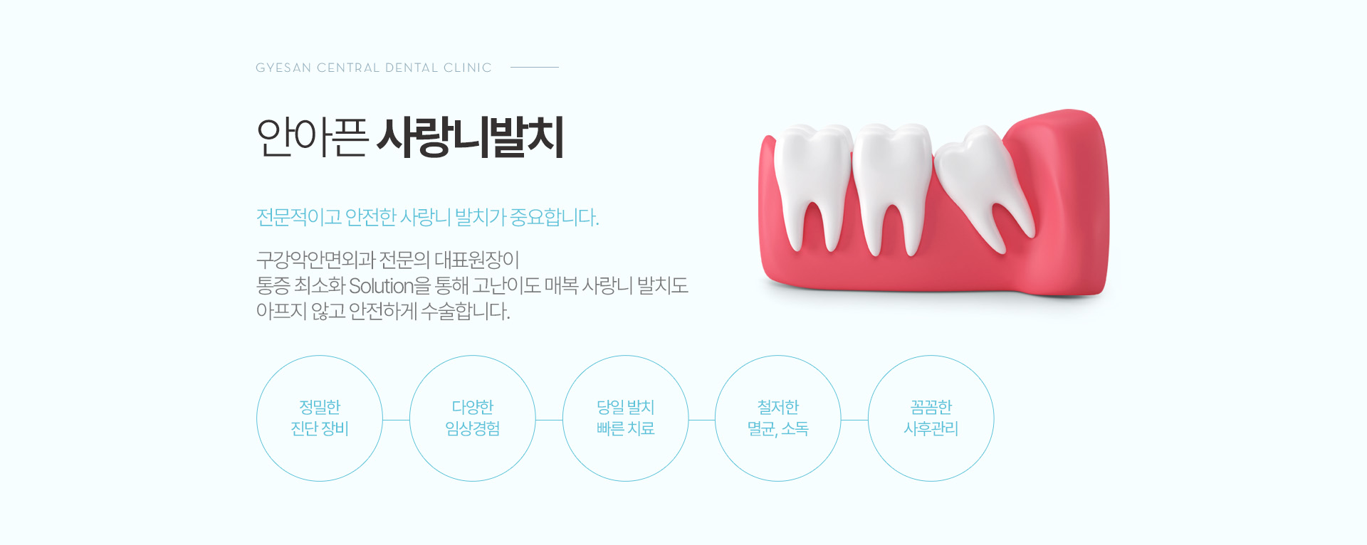 안아픈 사랑니발치