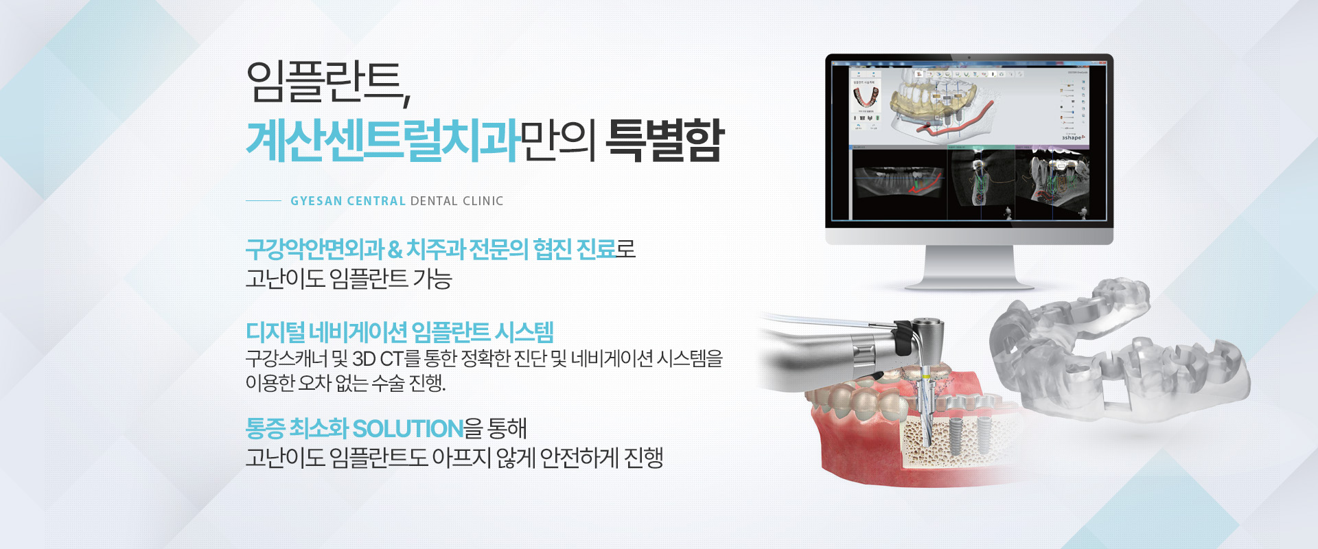 임플란트, 계산센트럴치과만의 특별함